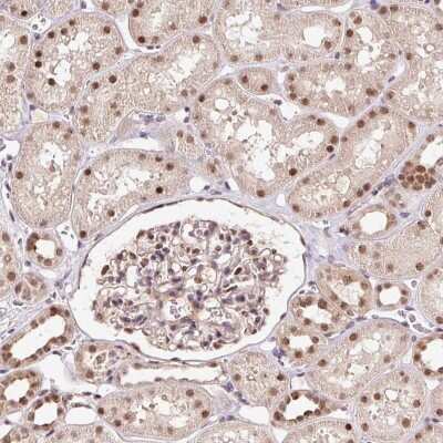 Immunohistochemistry-Paraffin: RFC4 Antibody [NBP2-48927]