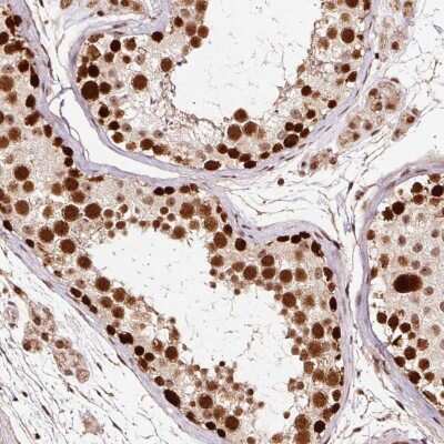 Immunohistochemistry-Paraffin: RFC4 Antibody [NBP2-48927]