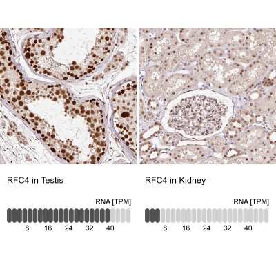 Immunohistochemistry-Paraffin: RFC4 Antibody [NBP2-48927]