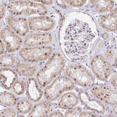 Immunohistochemistry-Paraffin: RFC4 Antibody [NBP2-49283]