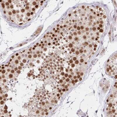 Immunohistochemistry-Paraffin: RFC4 Antibody [NBP2-49283]