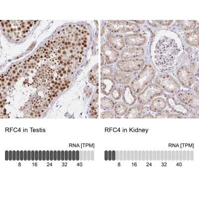 Immunohistochemistry-Paraffin: RFC4 Antibody [NBP2-49283]