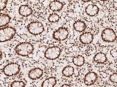 Immunohistochemistry-Paraffin: RFC4 Antibody [NBP2-97936]