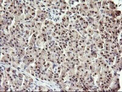 Immunohistochemistry: RFC4 Antibody (OTI1A8) - Azide and BSA Free [NBP2-73859]