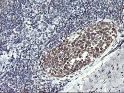 Immunohistochemistry: RFC4 Antibody (OTI1A8) - Azide and BSA Free [NBP2-73859]