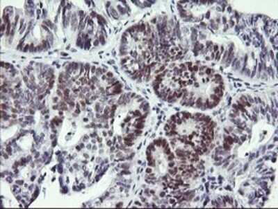 Immunohistochemistry: RFC4 Antibody (OTI1A8) [NBP2-45946]