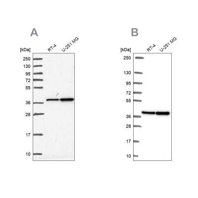 Western Blot: RFC4 Antibody [NBP2-48927]