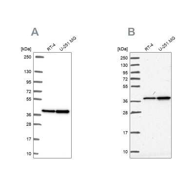 Western Blot: RFC4 Antibody [NBP2-49283]