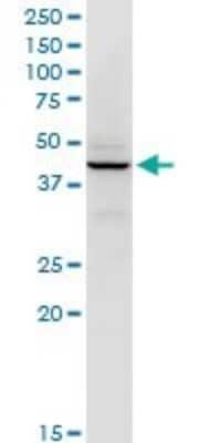 Western Blot: RFC5 Antibody (1B1) [H00005985-M01]