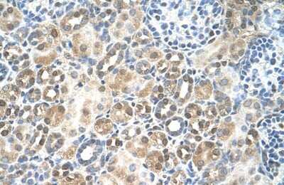 Immunohistochemistry-Paraffin: RFC5 Antibody [NBP1-58108]