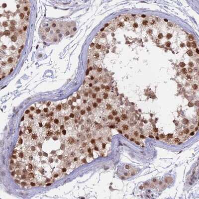 Immunohistochemistry-Paraffin: RFC5 Antibody [NBP1-87137]