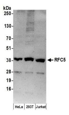 Western Blot: RFC5 Antibody [NB100-235]