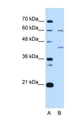 Western Blot: RFC5 Antibody [NBP1-58108]