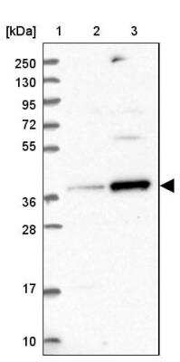 Western Blot: RFC5 Antibody [NBP1-87137]