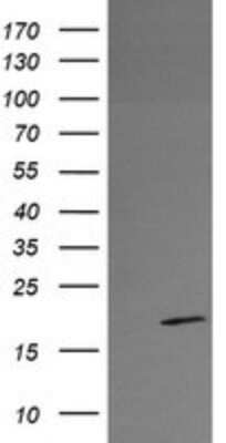 Western Blot: RFESD Antibody (OTI2A7) [NBP2-45947]