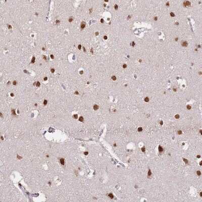 Immunohistochemistry: RFK Antibody [NBP2-48563]