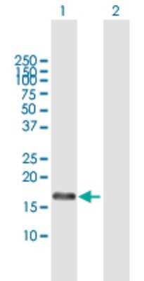 Western Blot: RFK Antibody [H00055312-B01P]