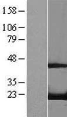 Western Blot: RFK Overexpression Lysate [NBL1-15297]