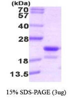 SDS-PAGE: Recombinant Human RFK His Protein [NBP1-30190]