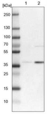 Western Blot: RFNG Antibody [NBP1-90946]