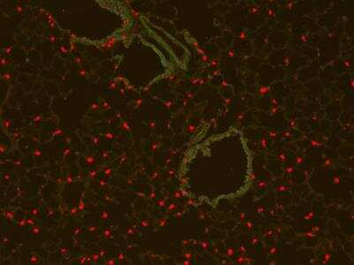 Immunocytochemistry/ Immunofluorescence: RFP Antibody [NBP1-69962]