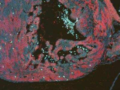 Immunocytochemistry/ Immunofluorescence: RFP Antibody [NBP1-69962]