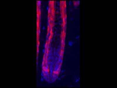 Immunocytochemistry/ Immunofluorescence: RFP Antibody [NBP1-69962]