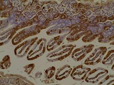 Immunohistochemistry: RFP Antibody [NBP1-69962]
