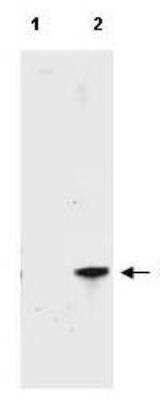 Western Blot: RFP Antibody [NBP1-69962]