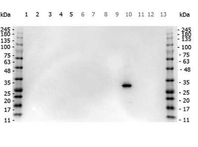 Western Blot: RFP Antibody [NBP1-69962]