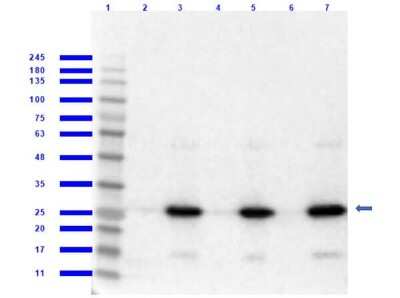 Western Blot: RFP Antibody [NBP1-69962]
