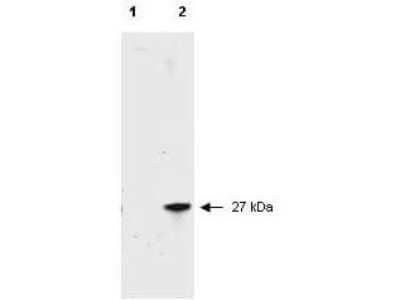 Western Blot: RFP Antibody [NBP1-69962]