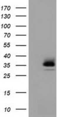 Western Blot: RFPL1 Antibody (OTI1D3) [NBP2-02835]