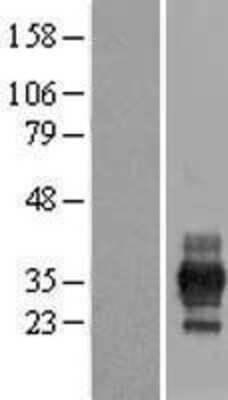 Western Blot: RFPL1 Overexpression Lysate [NBL1-15299]