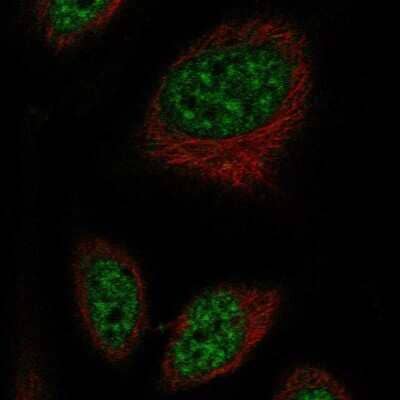 Immunocytochemistry/ Immunofluorescence: RFPL2 Antibody [NBP2-57626]