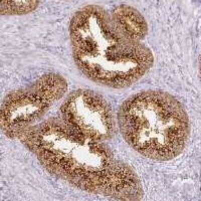 Immunohistochemistry-Paraffin: RFPL2 Antibody [NBP3-17758]