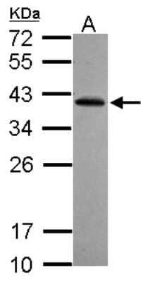 Western Blot: RFPL2 Antibody [NBP2-20138]