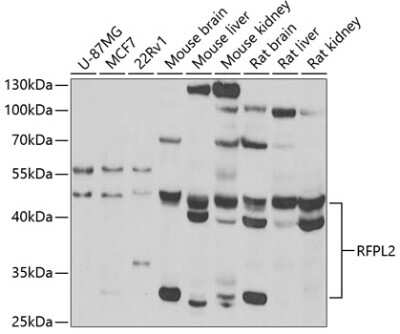 Western Blot: RFPL2 AntibodyBSA Free [NBP2-93268]