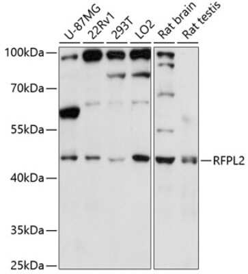 Western Blot: RFPL2 AntibodyAzide and BSA Free [NBP2-93702]