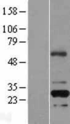 Western Blot: RFPL2 Overexpression Lysate [NBL1-15300]