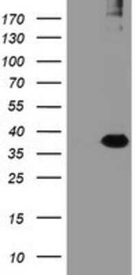 Western Blot: RFPL3 Antibody (OTI2G4) [NBP2-02034]