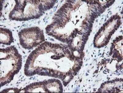 Immunohistochemistry: RFPL3 Antibody (OTI2G4) - Azide and BSA Free [NBP2-73862]