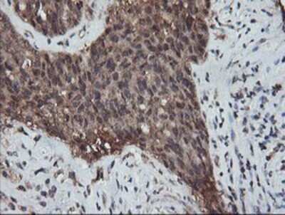 Immunohistochemistry: RFPL3 Antibody (OTI2G4) - Azide and BSA Free [NBP2-73862]