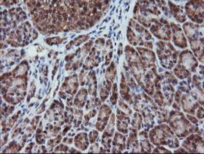 Immunohistochemistry: RFPL3 Antibody (OTI2G4) - Azide and BSA Free [NBP2-73862]