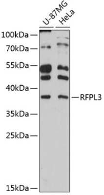 Western Blot: RFPL3 AntibodyAzide and BSA Free [NBP2-93982]