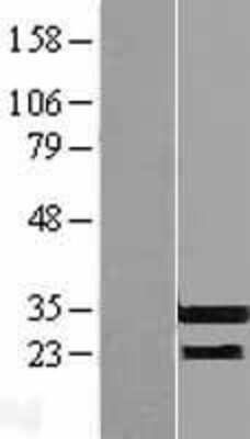 Western Blot: RFPL3 Overexpression Lysate [NBL1-15301]