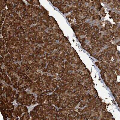 Immunohistochemistry-Paraffin: RFPL4A Antibody [NBP2-13222]
