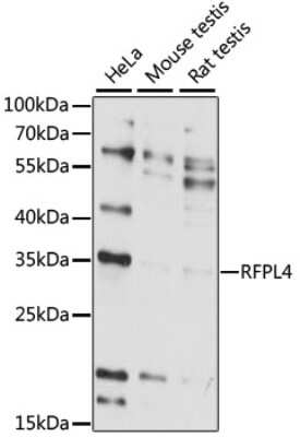 Western Blot: RFPL4A AntibodyAzide and BSA Free [NBP2-93598]