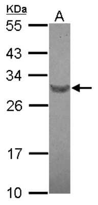 Western Blot: RFPL4B Antibody [NBP2-20140]