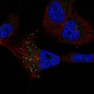 Immunocytochemistry/ Immunofluorescence: RFT1 Antibody [NBP2-56931]